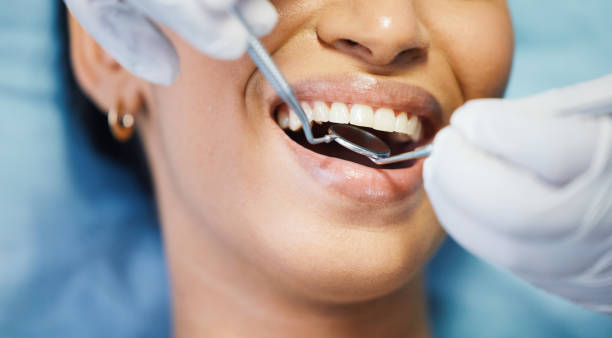 Best Emergency Tooth Extraction in Choctaw Lake, OH