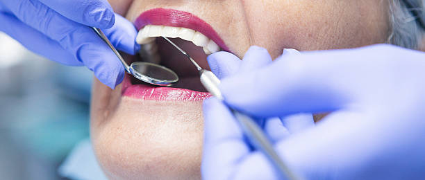 Best Emergency Tooth Extraction in Choctaw Lake, OH